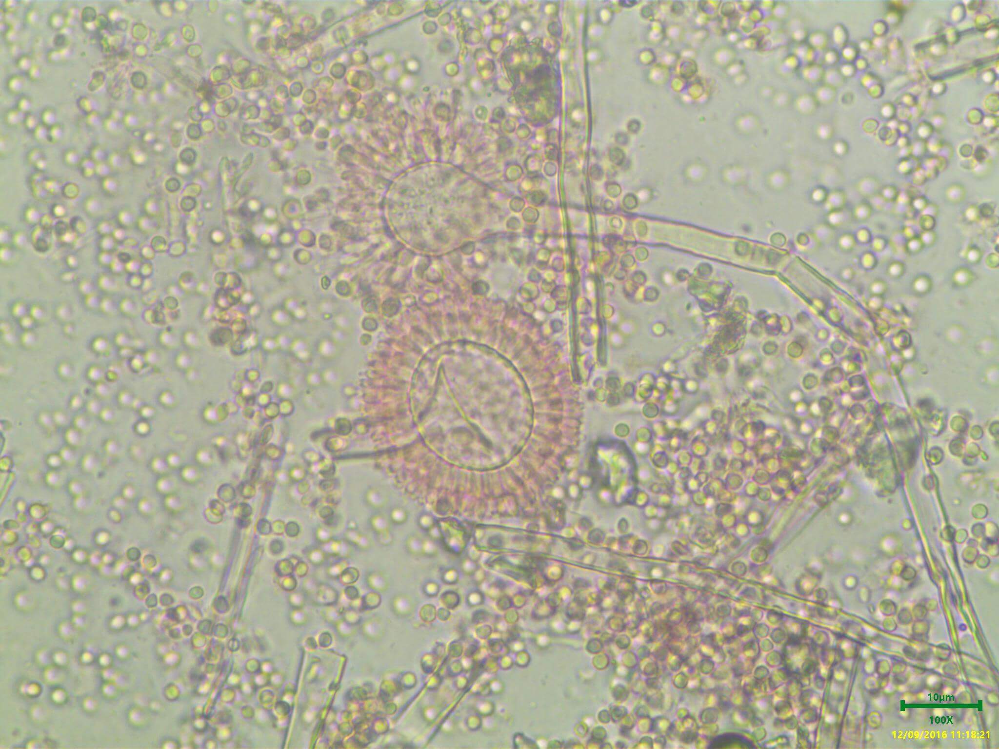 Trichoderma viride microscope