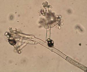 Chaetomium globosum 1