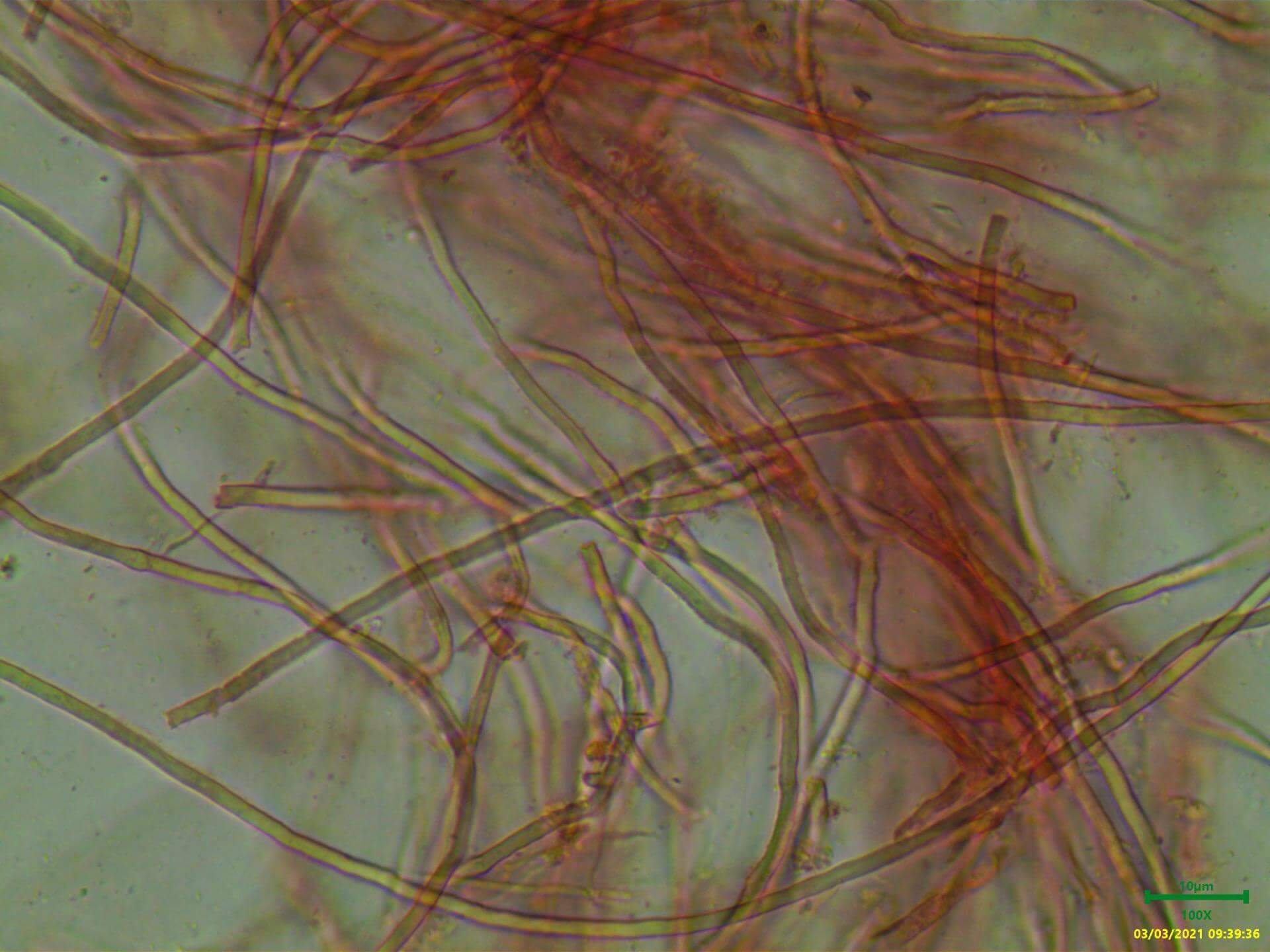 Clinique vétérinaire Sainte Anne - Observation de champignons 🍄  Microsporum canis et Trichophyton à la lampe de Wood. Ils sont responsables  de l'infection contagieuse nommée la Teigne. Les signes cliniques sont  reconnaissables