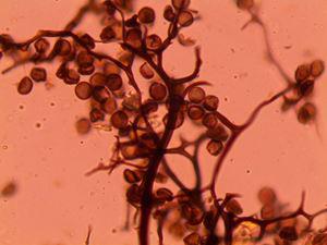 Chaetomium globosum 1