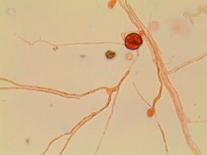 Chaetomium globosum 1