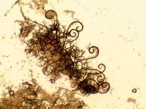 Chaetomium globosum 2