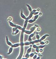 Trichoderma viride microscope