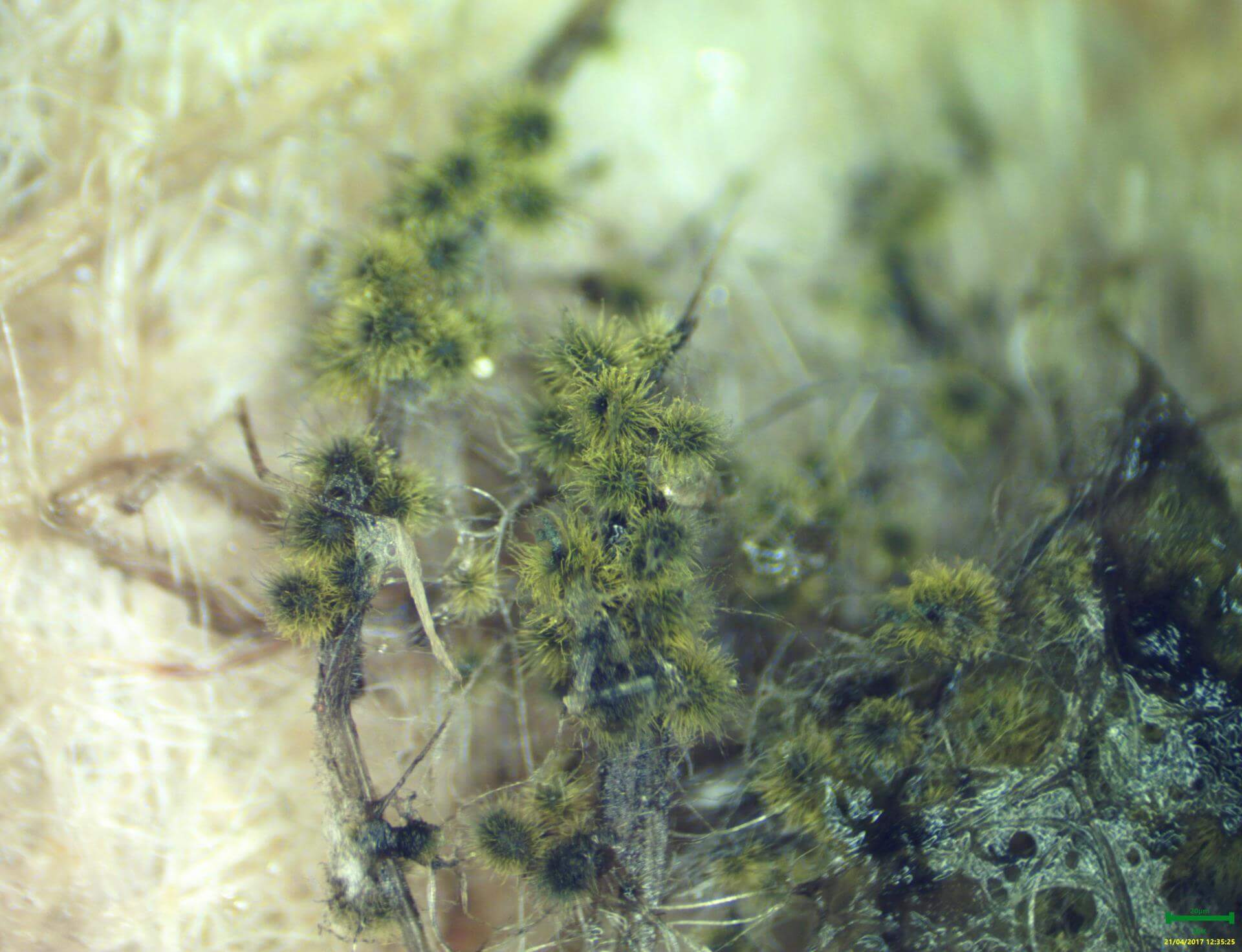 Analyse en laboratoire du champignon Chaetomium globosum au microscope.