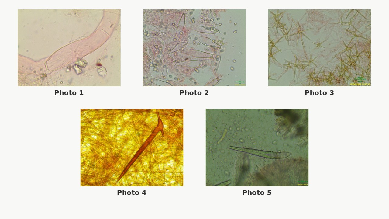 Observation en laboratoire des structures microscopiques de champignons : hyphe vasculaire, cystides à crochet, asterosetae, soie hyméniale et lamprocystide